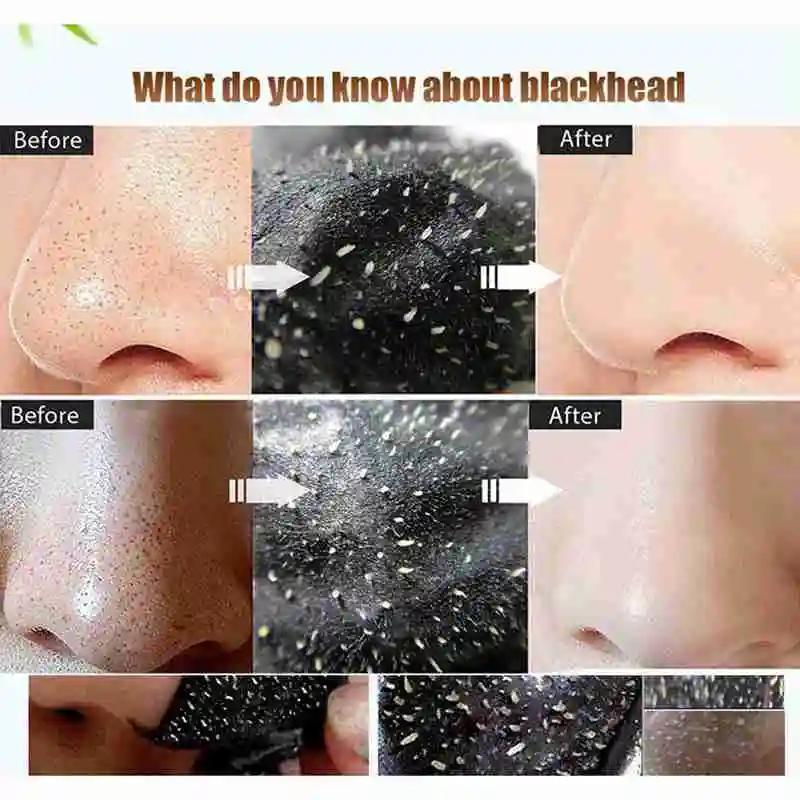 

Blackhead Removal Nose Strips Masks Deep Cleansing Charcoal Care Purifying Dots Masks Face Skin Black Acne Bamboo T6J3