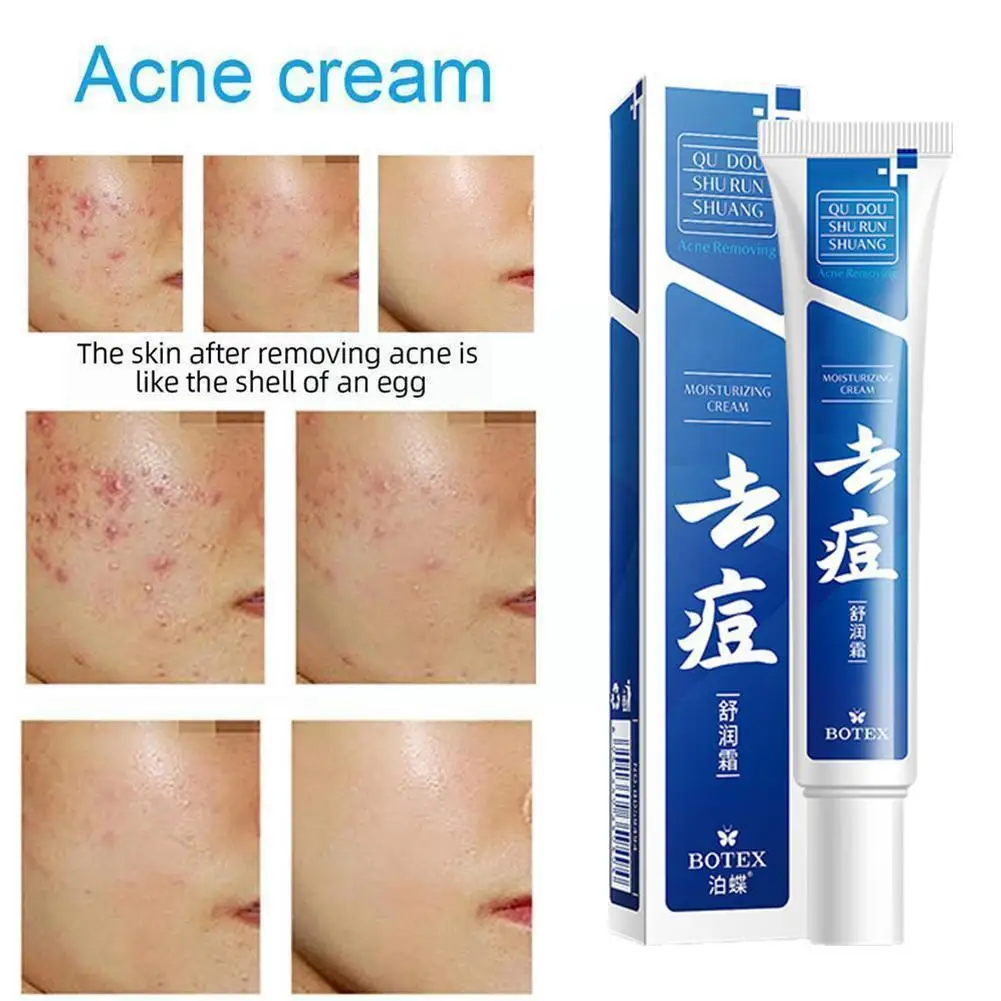 

Acne Moisturizing Cream Oil Control Moisturizing Cleansing Facial Acne Skin Products Facial Cream Care Care N6C5