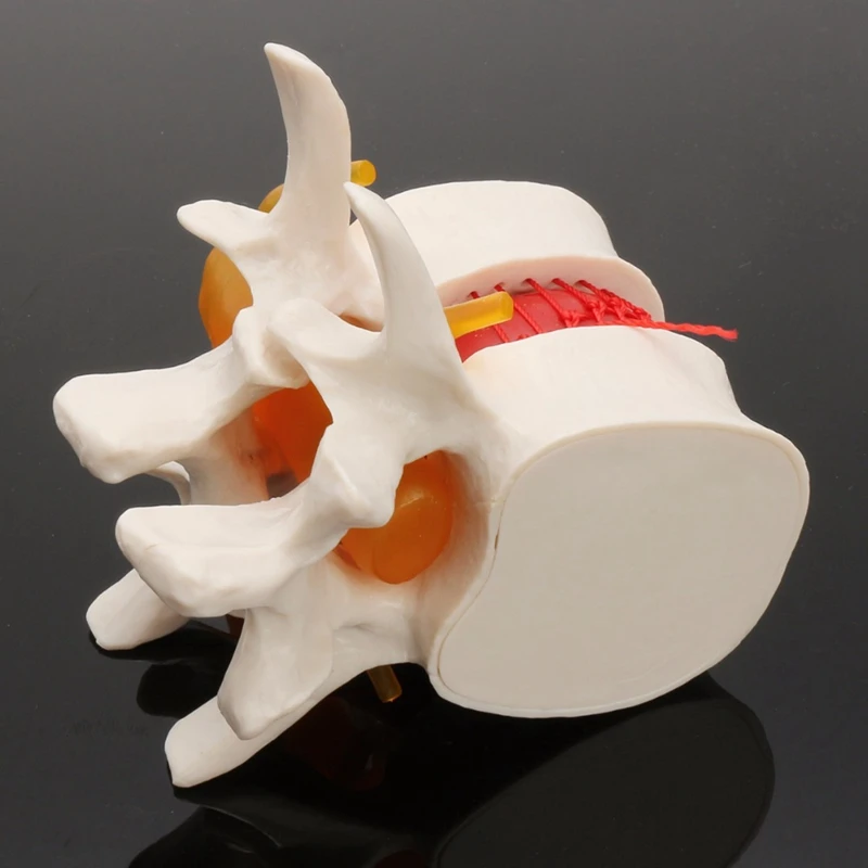

FashionHuman Anatomy Skeleton Spine Lumbar Disc Herniation Teaching Model Brain Skull Traumatic School Supplies Instrume