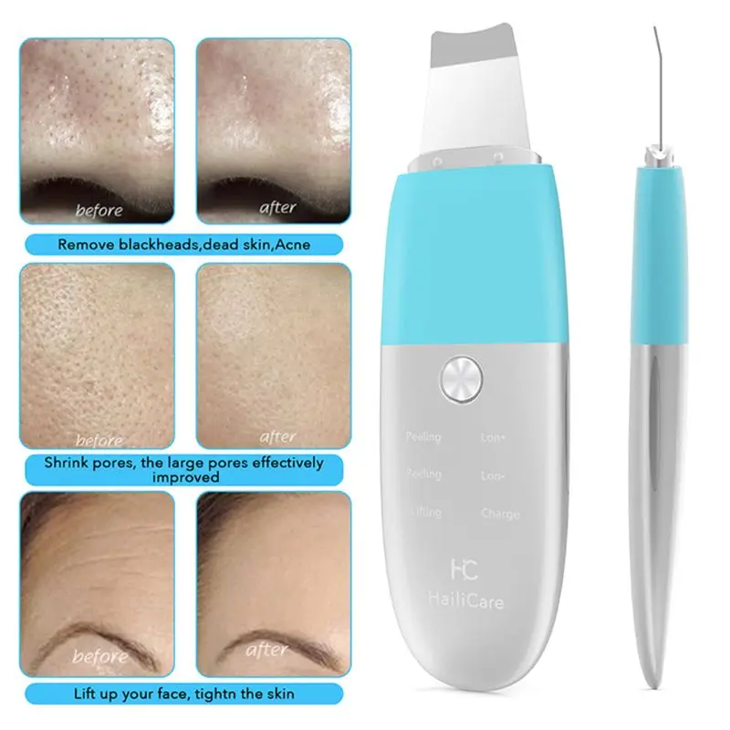 1 компл. Ультразвуковой Скруббер кожи USB удаления угрей массажер для лица