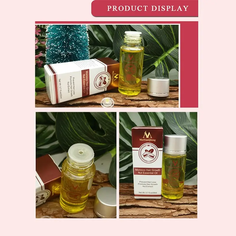 Быстрорастущий имбирь для волос средство лечения выпадения масло роста шампунь