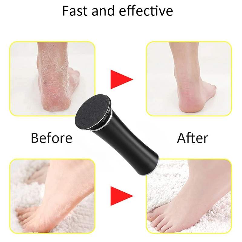 

Top Sale Electric Foot Care For Pedicure Electric Grinding Foot File Pedicure Dead Skin Heel-File Callus Remover Shaver Tools Re