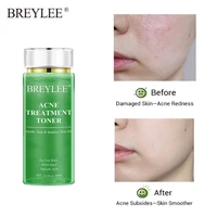 breylee acne treatment toner oil control moisturizing pimple removal shrink pores soothing acne whiten tea tree face serum 100ml