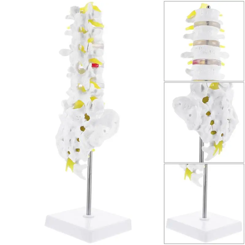 

Medical Anatomy Model Lumbar Spine Model Lumbar Anatomy Model for Teaching