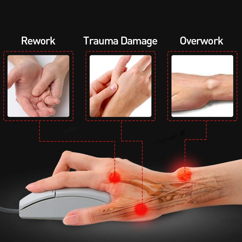 12 шт. обезболивающие Пластыри для суставов при артрите|Пластыри терапевтические|