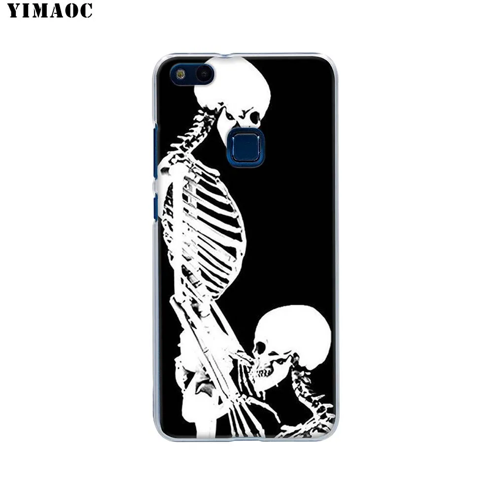 Чехол для телефона Skeletoff after life из ТПУ Xiao mi Red 7 7A 8 8A K20 Note 6 Pro 9T 9 A3 мягкий чехол |