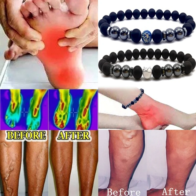 

HWetR Black Stone Magnet Anklet Colorful Magnetic Foot Chain Therapy jewelry