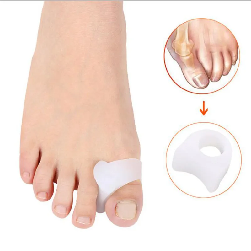 1 пара силиконовый разделитель для пальцев ног при вальгусной