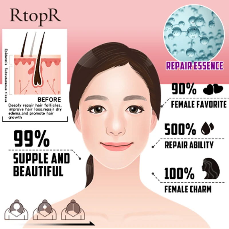 Травяное средство для роста волос жидкость против выпадения быстрого густых