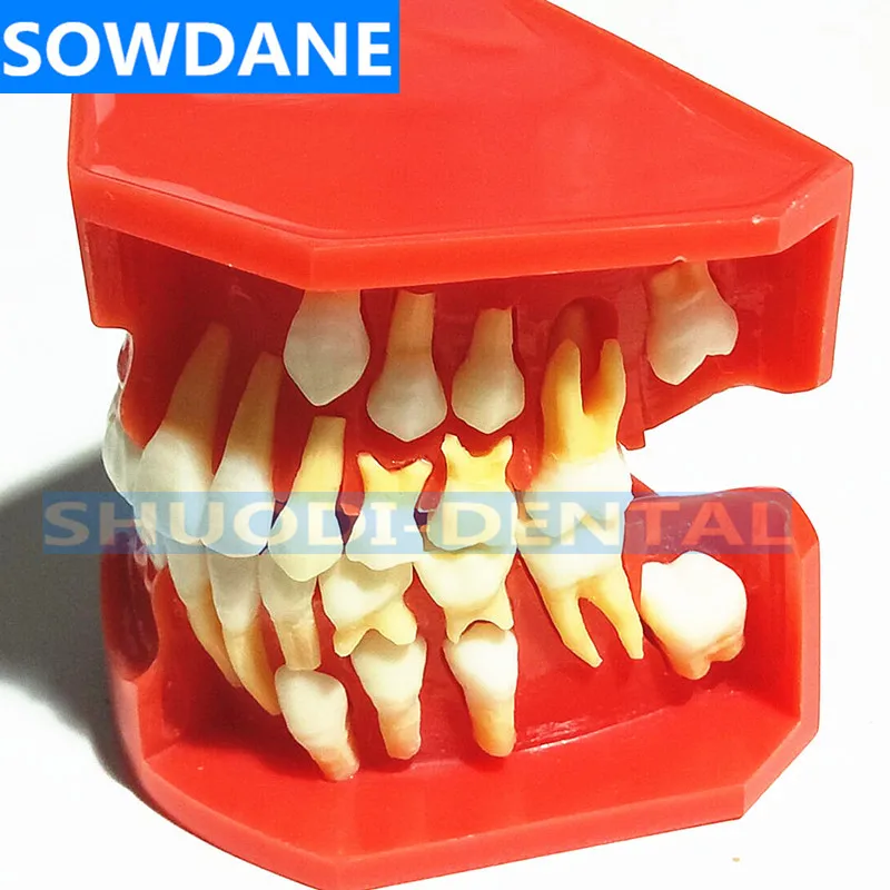 Стоматологическая детская модель выпадающих зубов сменная постоянные зубы