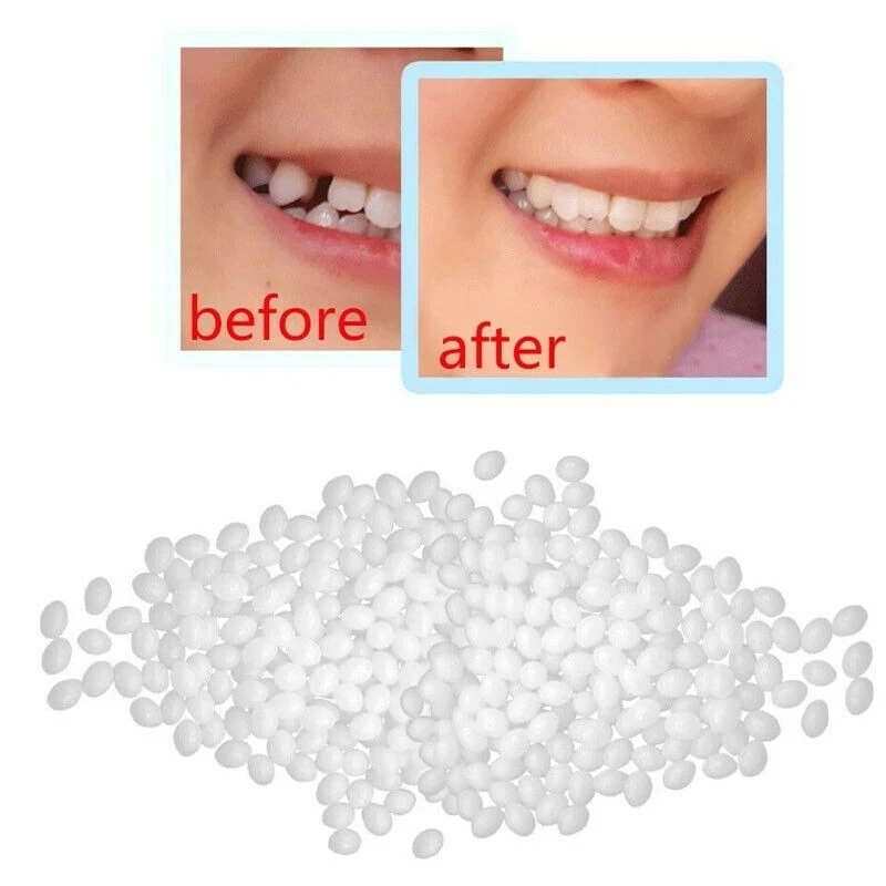 

100g Teeth And Gap Falseteeth Solid Glue Resin FalseTeeth Solid Glue Temporary Tooth Repair Set Denture Adhesive Teeth Dentist