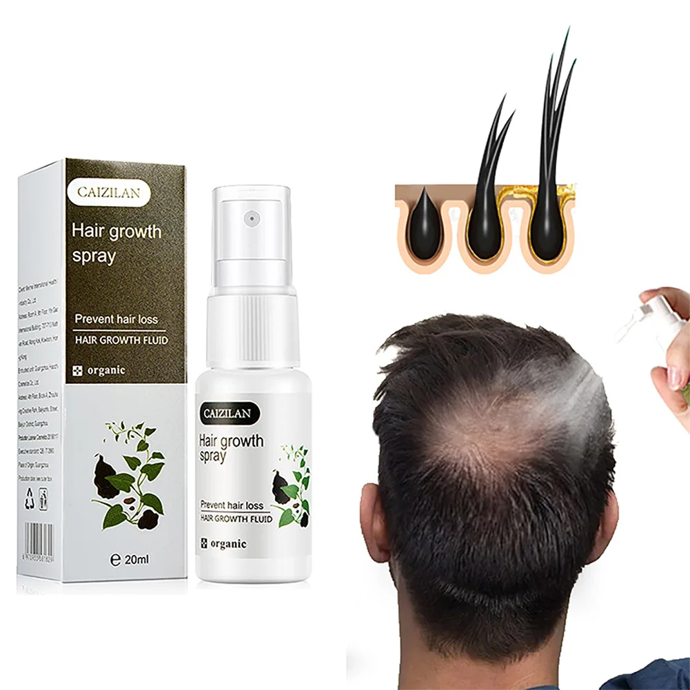 

20ml Polygonum Multiflorum Hair Growth Spray Serum Anti Prevent Hair Loss Fast Grow Moisturize repair hair Healthy growth liquid