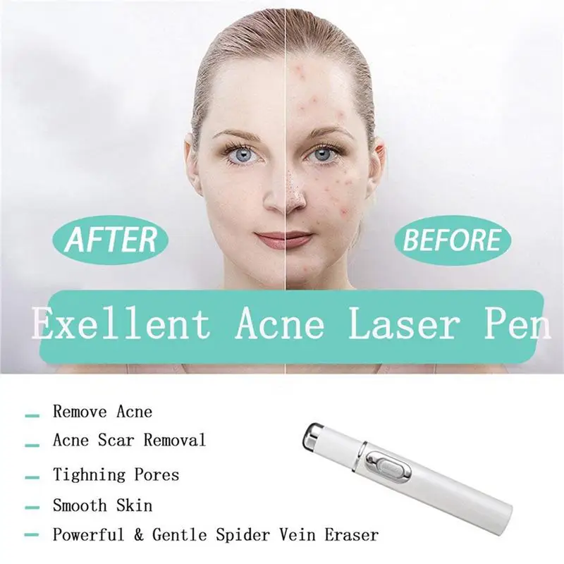

New Heath Blue Light Therapy Varicose Veins Treatment Laser Pen Soft Scar Wrinkle Removal Treatment Acne Laser Pen Massage Relax