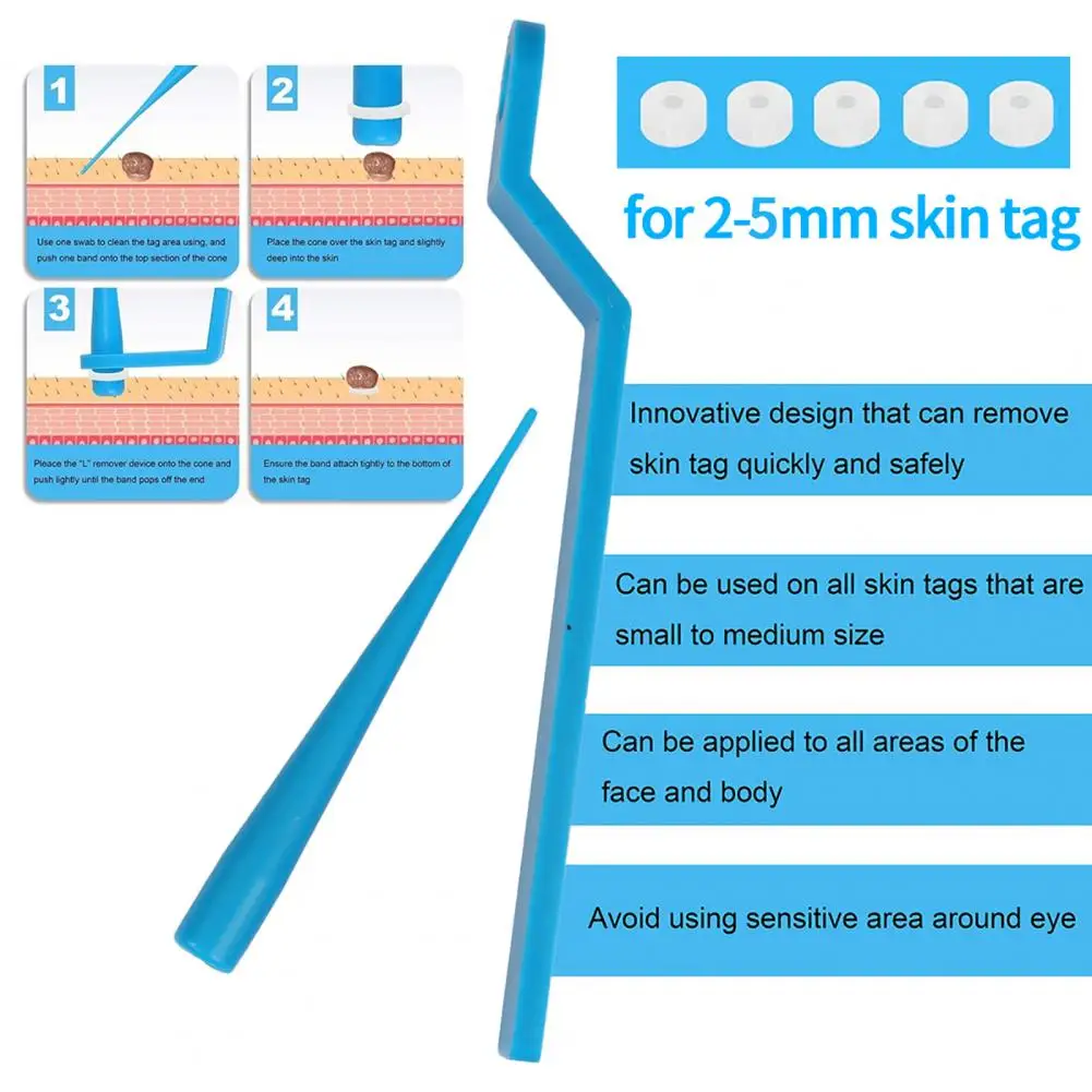 

Medical Skin Tag Kill Skin Mole Wart Remover Micro Band Skin Tag Removal Kit With Cleansing Swabs Adult Mole Wart Face Care