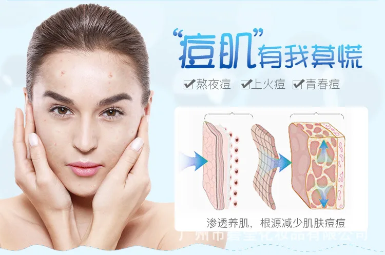 Увлажняющая Маска Anit-acne, контроль жирности, маска, не Wis, увлажняющая, усадочная косметика для пор и ухода за кожей