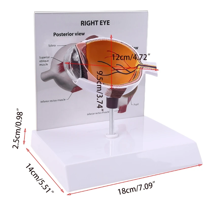 

Human Right Eye Eyeball Model Cross Section Anatomical Glaucoma Display Instrument Study Teaching Tool