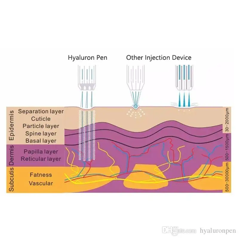 

0.3ml 0.5 lip filler hyaluronique pen Syringe Ampoule Needle acido hialuronico for Hyaluronic acid lip injection wrinkle removal
