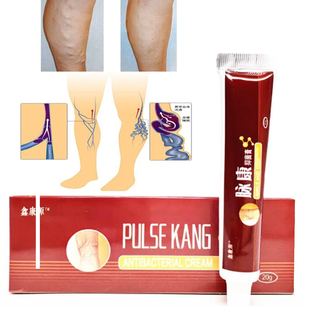 Крем от варикозного расширения ног вен боли в варикозном и паука 100% трав