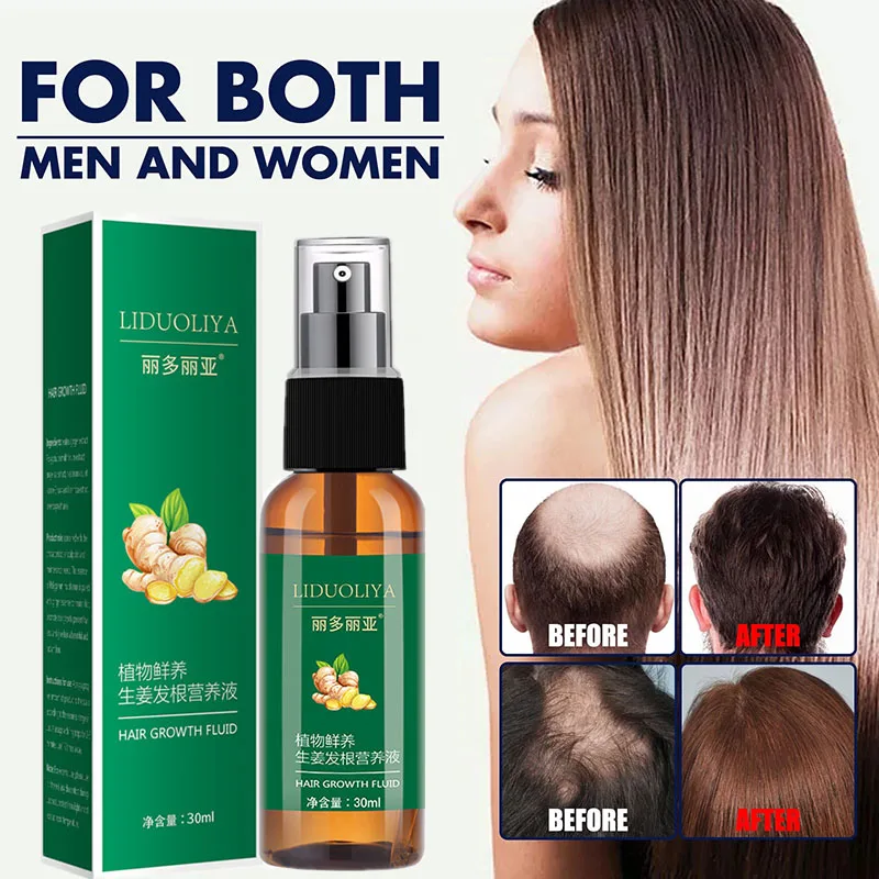 Новый спрей для роста волос, 30 мл, масло для выпадения волос, лечение для мужчин и женщин, продукты для истончения волос, уход за волосами для мужчин и женщин