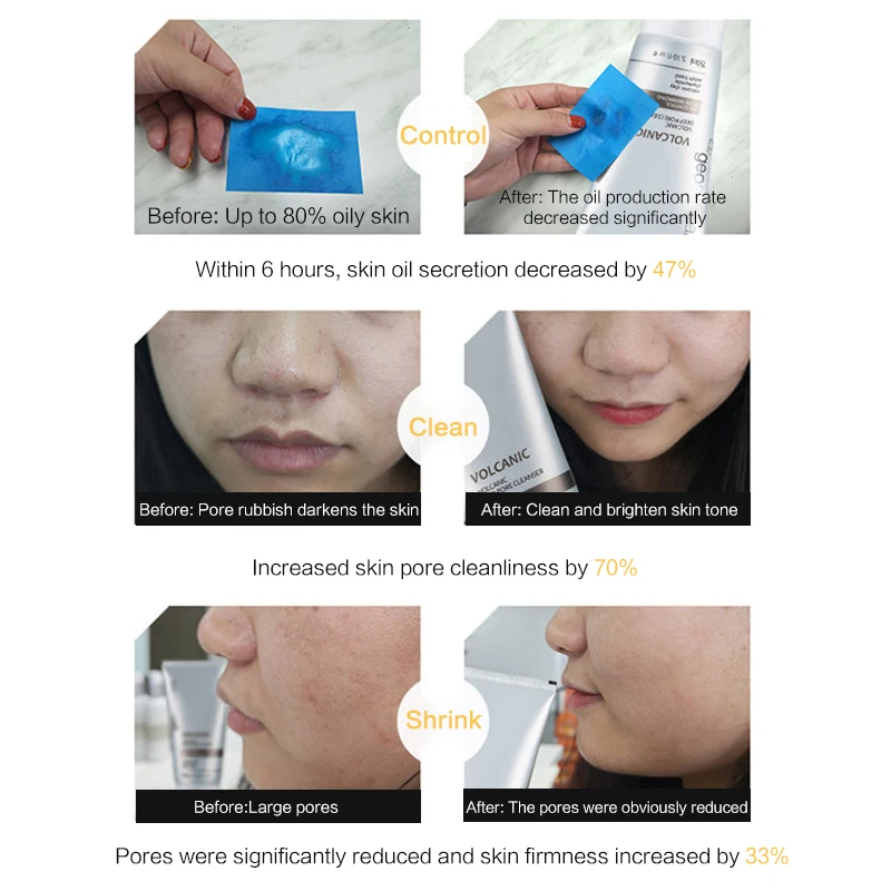 Geoskincare Face Cleanser Facial Cleansing Volcanic Rock Mud Pore 150ml Acne Oil Control Blackhead Remover Shrink Pores | Красота и