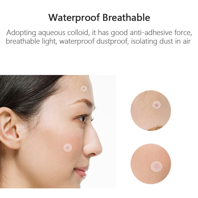 36 шт. новые патчи от акне и бирки для кожи набор красоты мастер лечения прыщей es