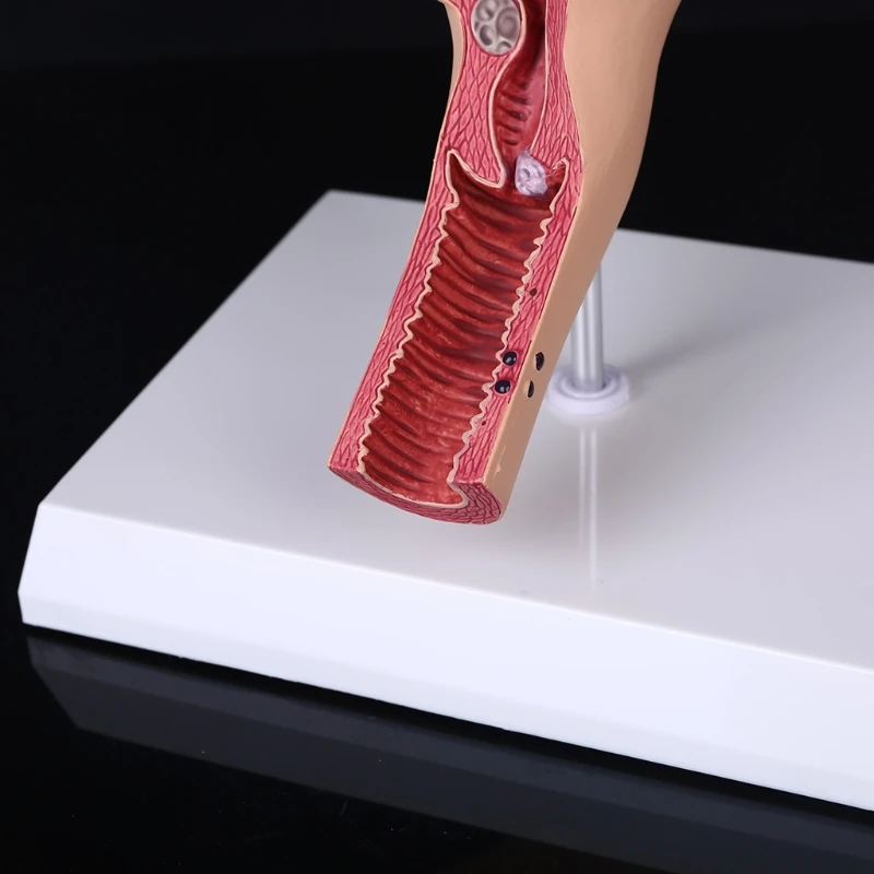 

Human Female Uterus Ovary Disease Dissection Pathology Model Biology Teaching Aids Anatomy Lesion Uterus 40JB