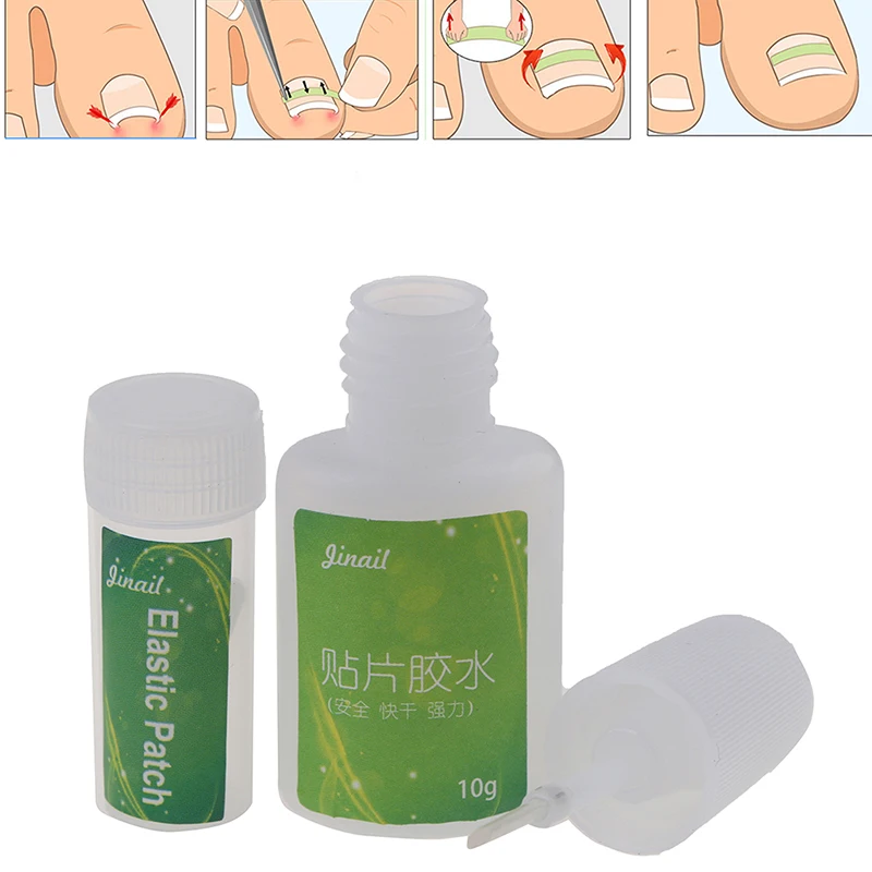 

Набор инструментов для коррекции вросших ногтей и педикюра с клеем