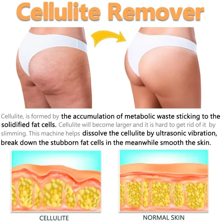 Goedkoop 500K Hoge Radio Frequentie Ems Ultrasone Vet Cavitatie Afslanken Massager Fototherapie Vet Brander Gewichtsverlies Cellulite Machine