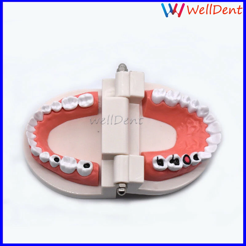 Стоматологическая модель зубов кариесы уход за зубами обучение