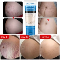 hot sale remove stretch mark cream to remove postpartum obesity pregnant women repair anti aging anti winkles firming body cream