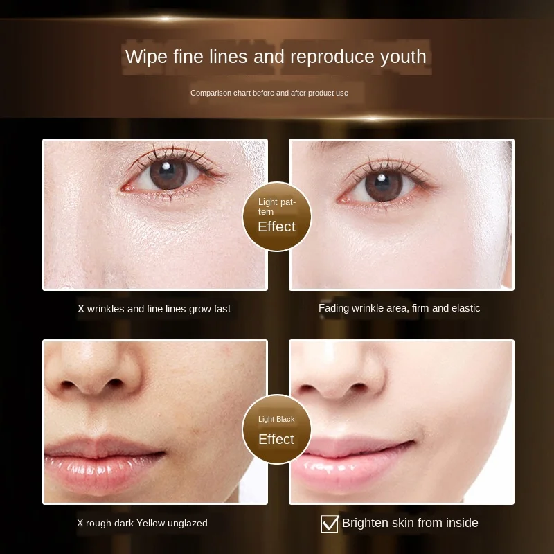 Экстракт ядhi Fullerene плаценты укрепляющая Антивозрастная эссенция против морщин