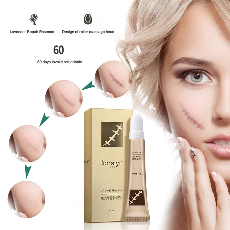 Lavender Scar Repair Cream Moisturizing Dilute Pigment Remove Scars Pimple Marks Acne Spots Whitening Cream TXTB1
