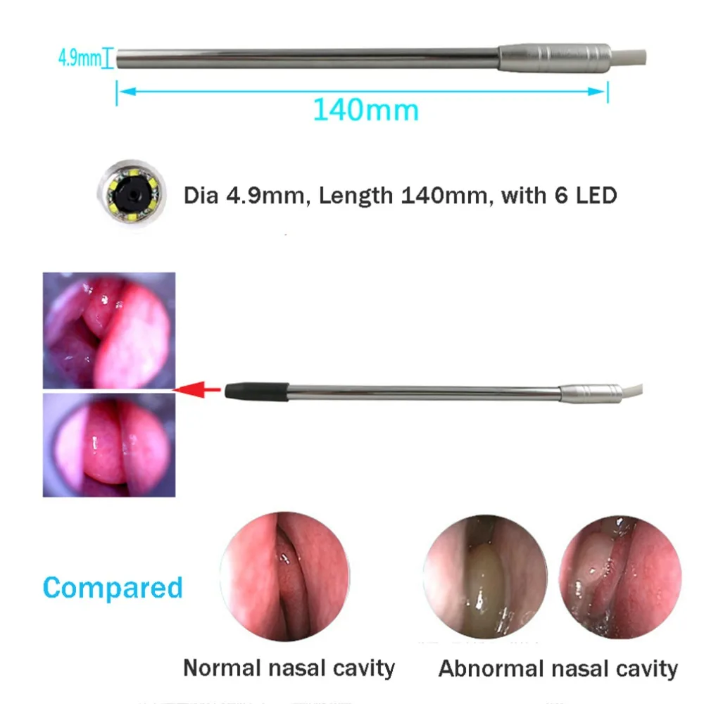 4.9mm Wireless WiFi Medical Endoscope Ear Otoscope Camera Waterproof For Android PC iphone IOS | Безопасность и защита