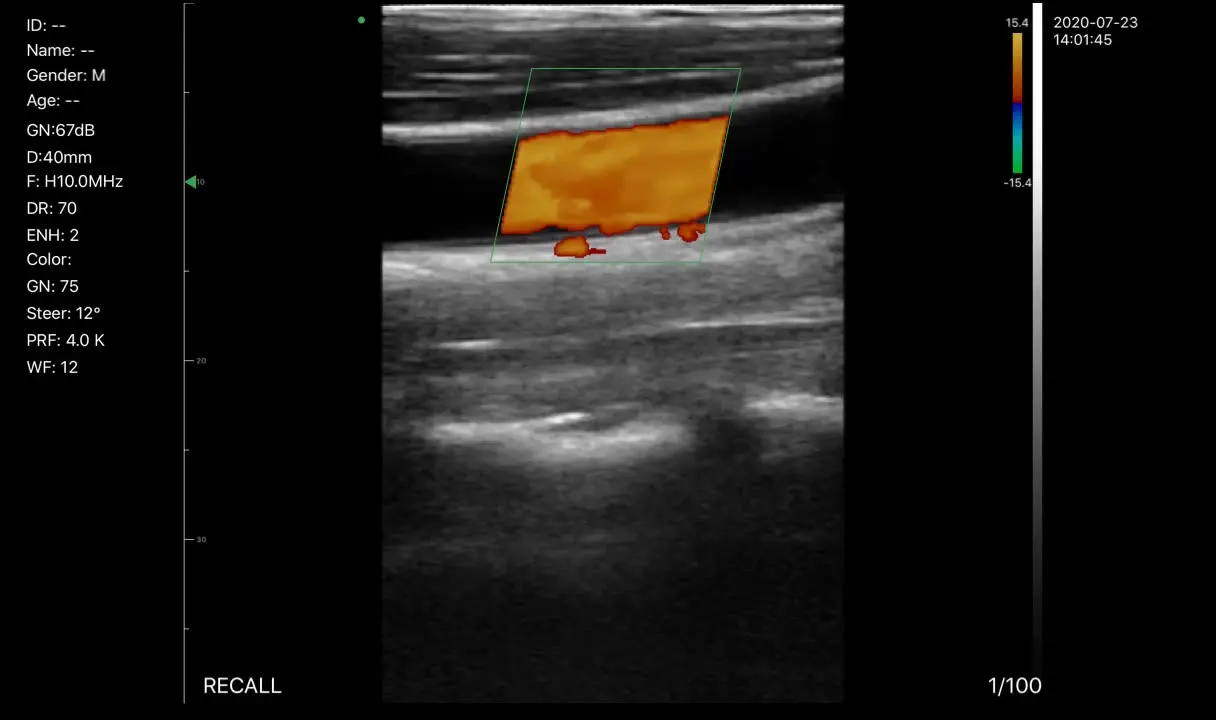 

Konted 5G Channel Ecografo wifi &USB Double Head C10RL 3 in 1 ultrasound probe Scanner