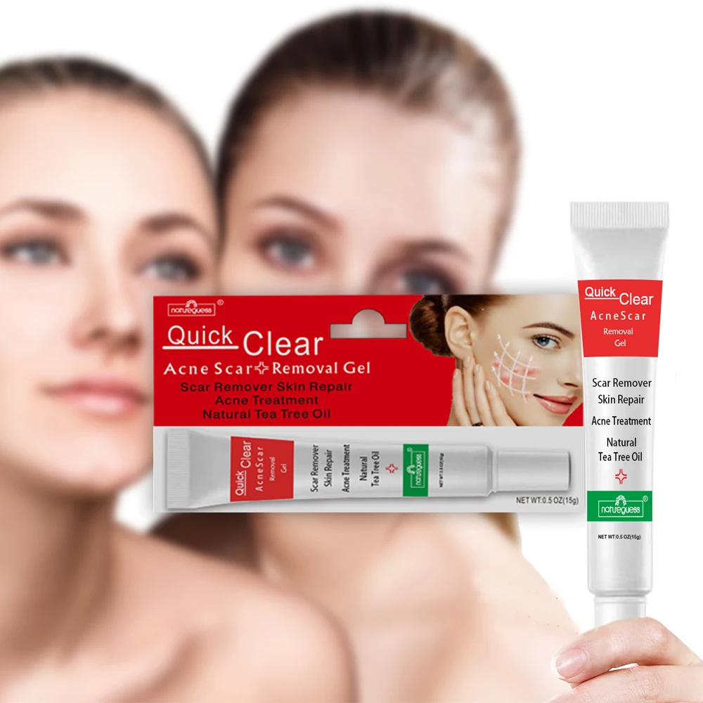 Эффективный крем для удаления акне 10 шт./лот лечение прыщей контроль жирности