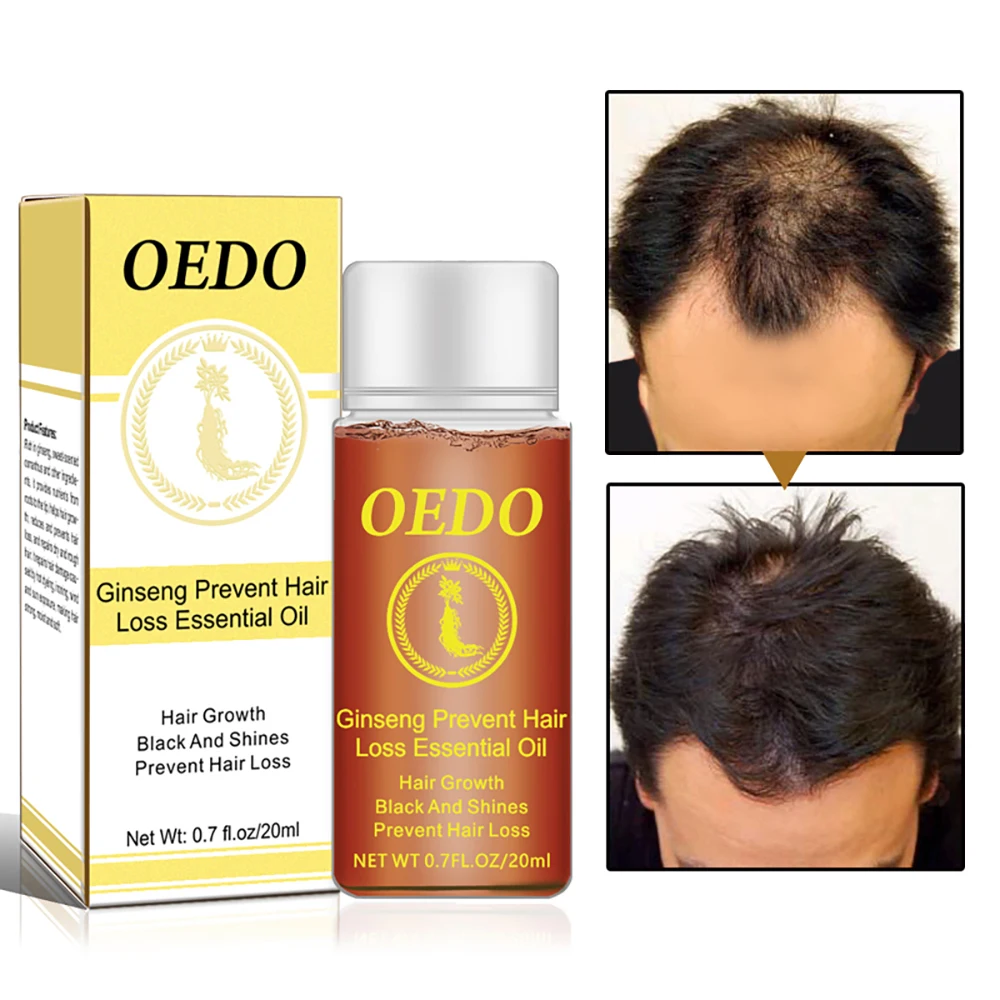 

20ML Ginseng Hair Growth Essence Preventing Hair Loss Liquid Damage Hair Repair Treatment Dense Fast Restoration Hair Growth