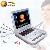 sun 800d laptop 3d charger ultrasound fetal doppler machine ultrasound portable ultrasound for pregnancy