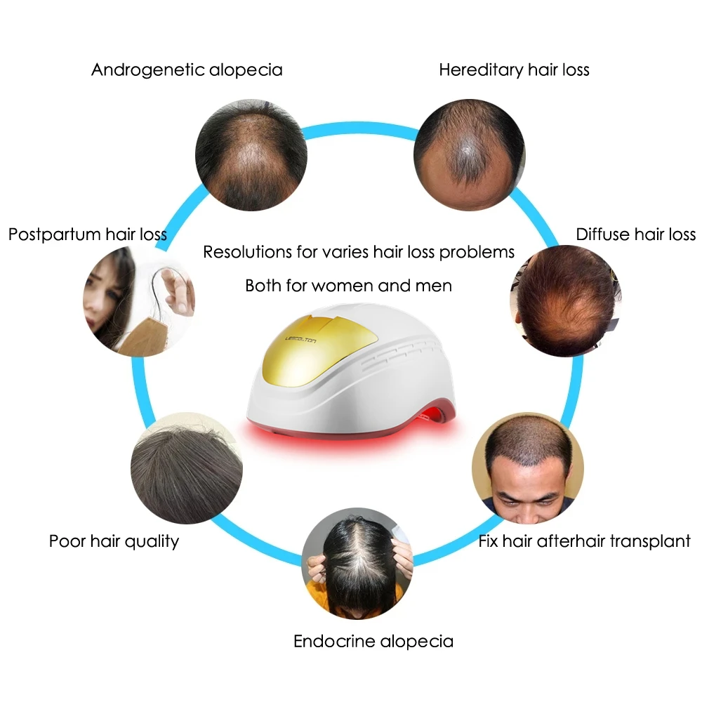 Шлем лазерный Lescolton для роста волос медицинский колпачок с 80 диодами лечения