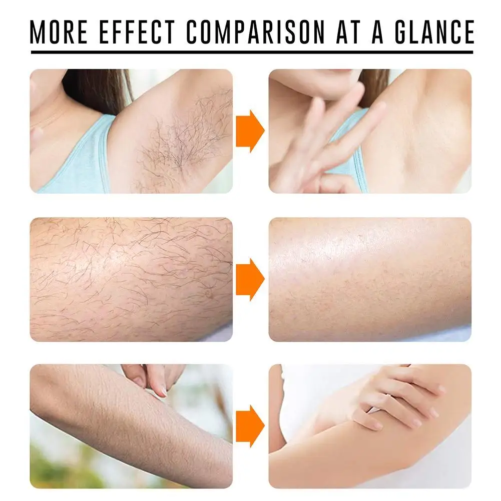 

Hair Removal Spray 50ml, Natural Hair Removal Spray Stop Underarms, On The To Painless, Growth And Legs, Shave Face Private W8F0