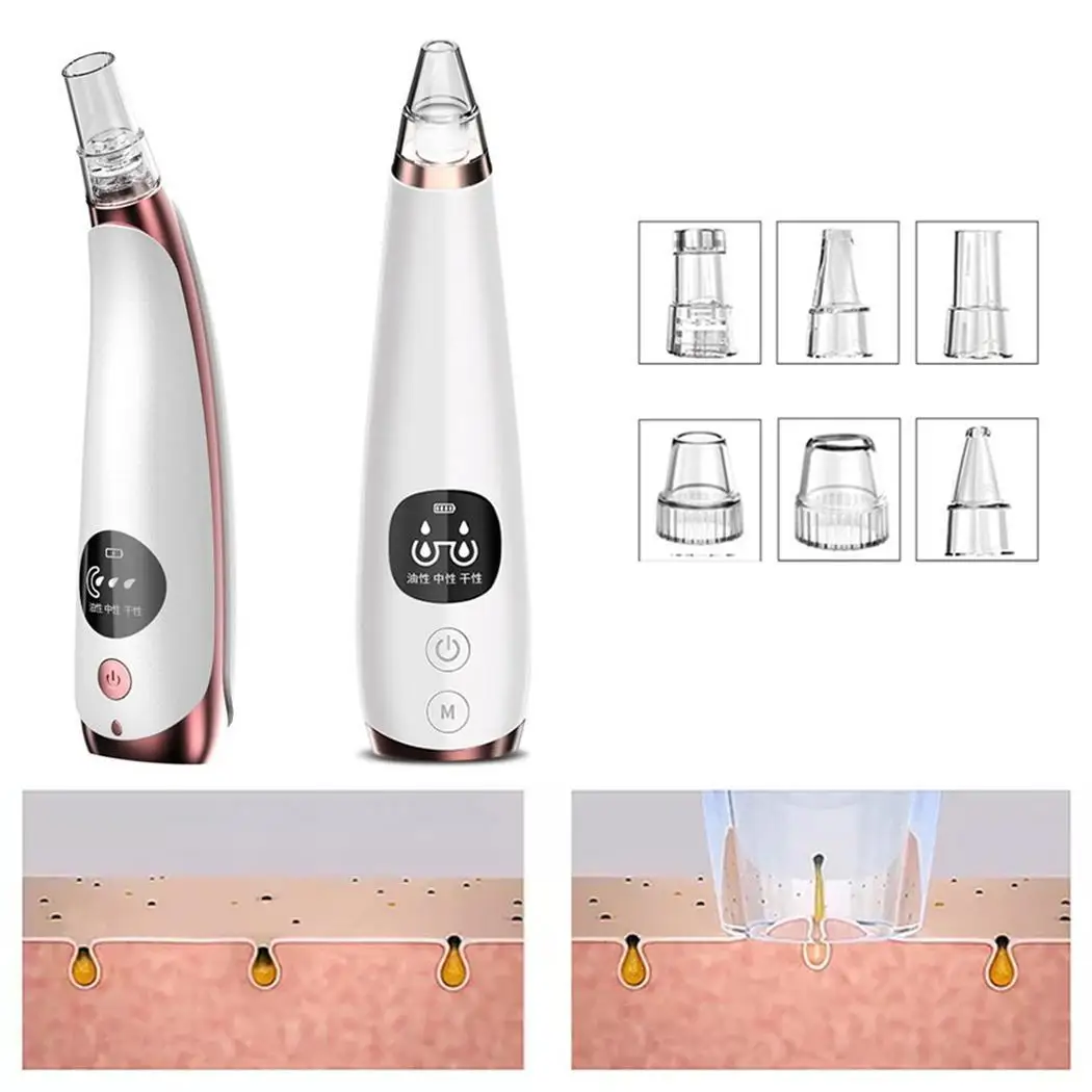 Женский электрический прибор для удаления черных точек с присоской черный 150 мин