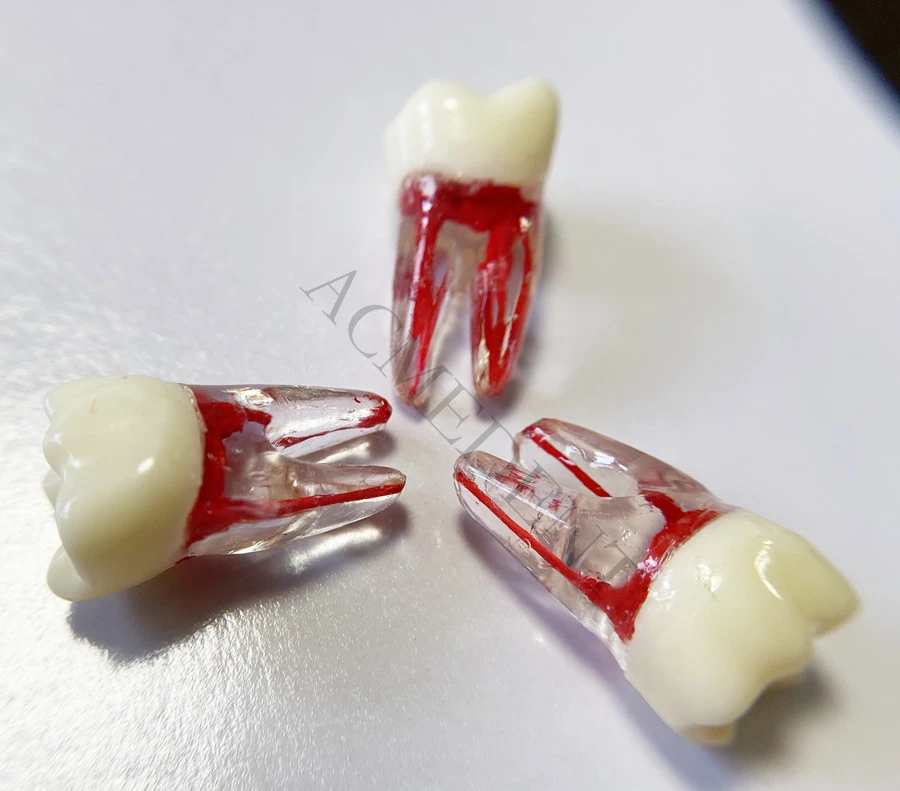 

1~100 Kilgore Nissin Dental Root Canal Teeth Red Pulp Cavity Model RCT Practice