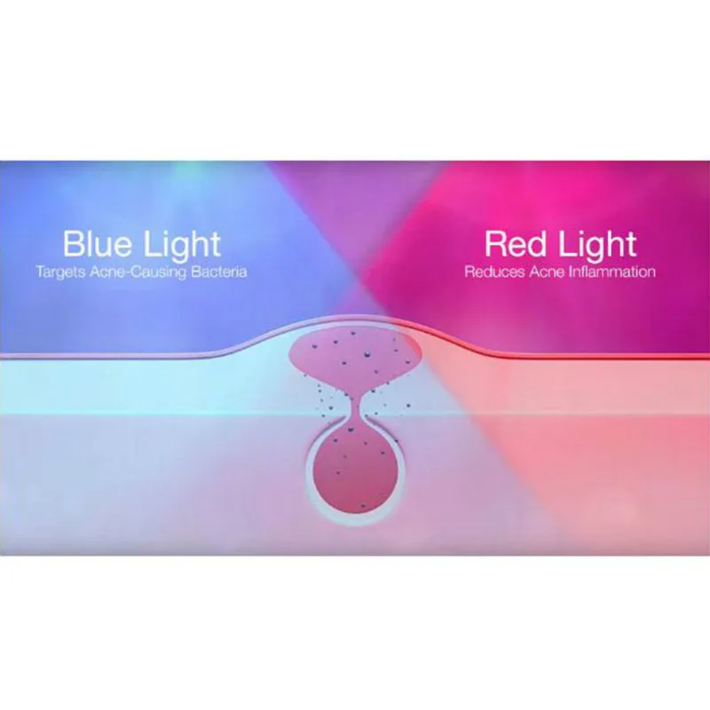 

Acne Pen Blue Red Light Therapy Acne Spot Treatment Laser Pen Scar Wrinkle Removal Device Acne Removal Face Care Tool