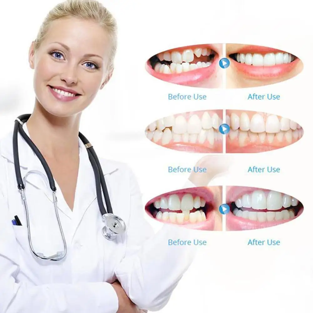 4D ортодонтический локатор Защита зубов Ортодонтические брекеты невидимые