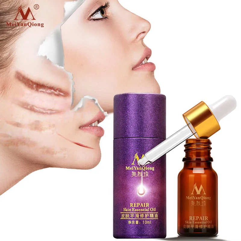 Подставка с зажимом для восстановления кожи эфирное масло эссенция лаванды