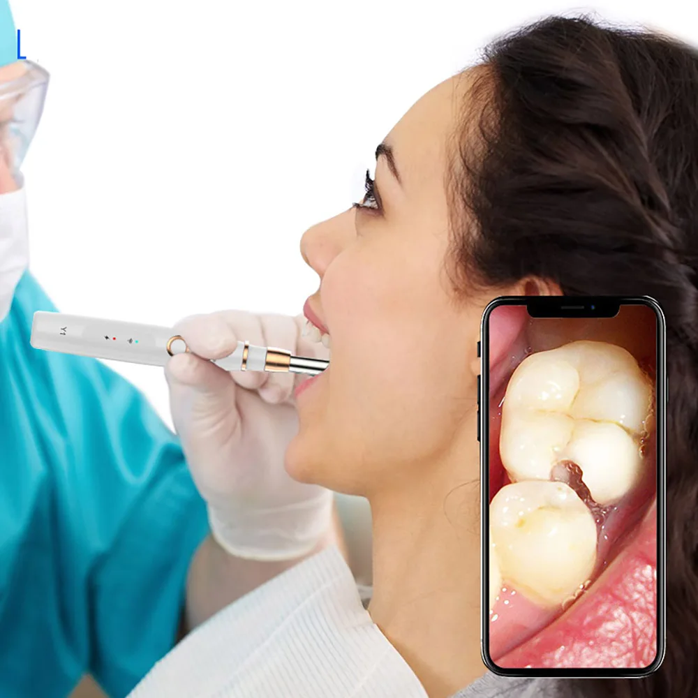 Инструменты для чистки ушей из нержавеющей стали зеркальные инструменты