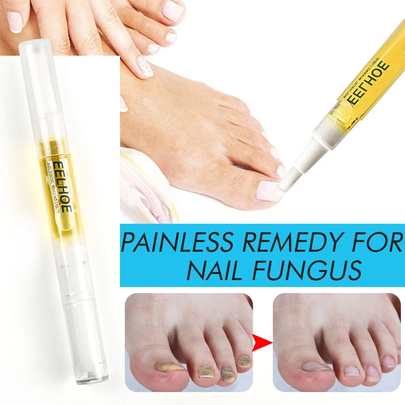 1/2 шт. антигрибковая жидкость для ногтей | Красота и здоровье