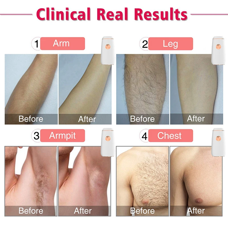 

US Plug Professional Permanent IPL Epilator Freezing Hair Removal Machine Electric Women Painless Hair Remover Device for Body F