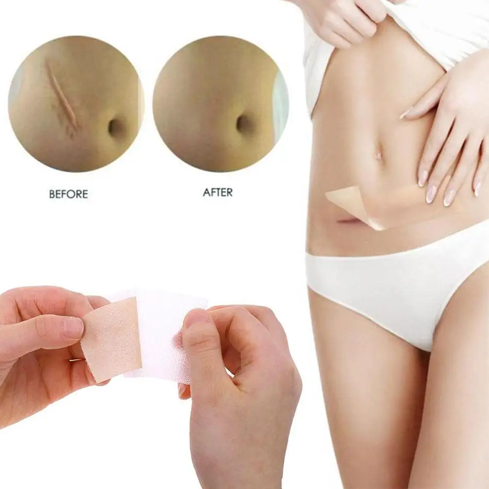 

4PCS Reusable Silicone Scar Sheets Removal Patch Acne Gel Scar Therapy Silicon Patch Remove Trauma Burn Sheet Skin Repair