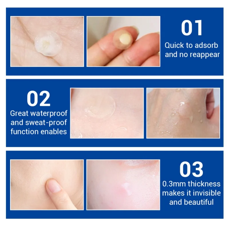 Acne Removal Patch Treatment Mask Anti Acne Stickers Blackhead Pimple Remover Face Washing Product Skin Care H5