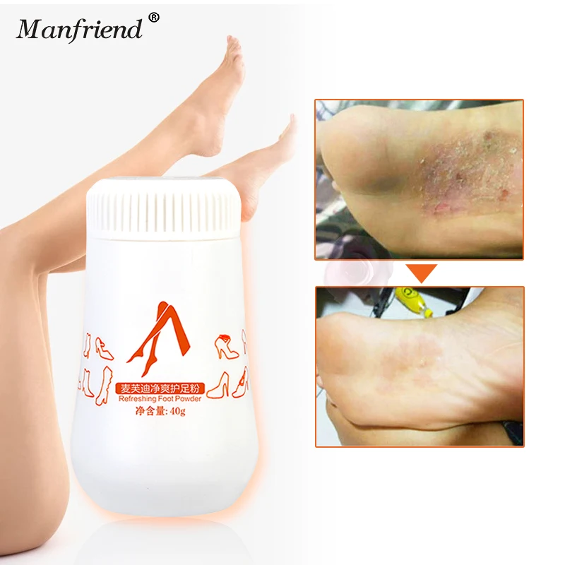 Пудра для ног средство устранения пота зуда бактерий крем ухода за ногами|Стопы| |